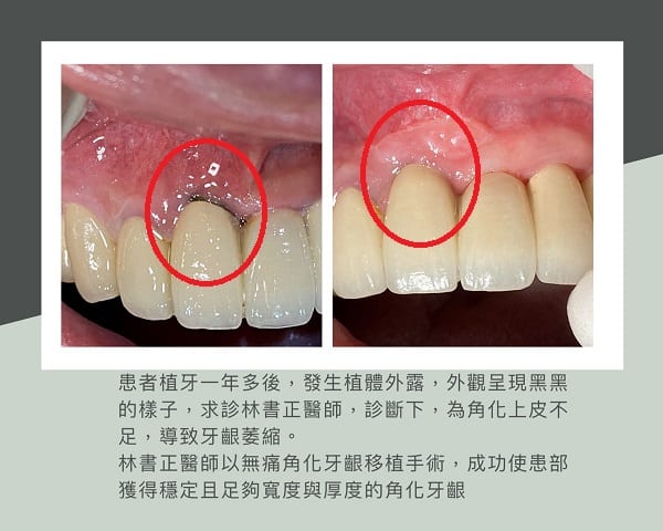 晶悅美學牙醫診所-林書正