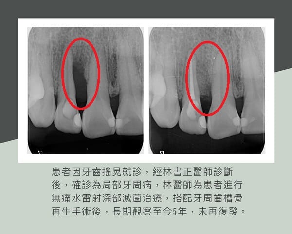 晶悅美學牙醫診所-林書正補骨